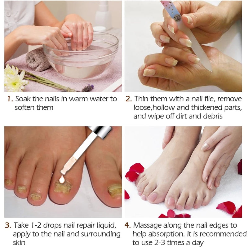 SUAI Nail Fungal Treatment Feet Care Essence Foot