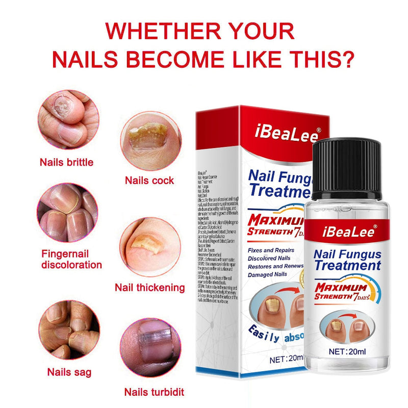 100% Original Nail Fungus Treatment 7DAYS Repair