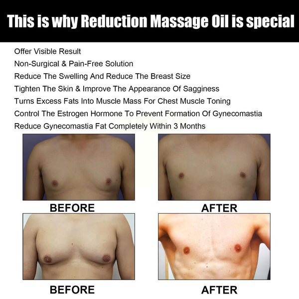 Gynecomastia Reduction Massage Oil