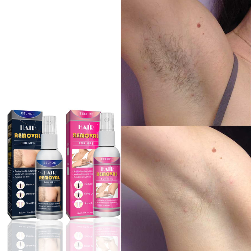 Hair Removal Permanent Inhibitor Spray For Men And Women